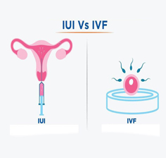 درمان ناباروری IVF و IUI دکتر رزا شاه حسینی
