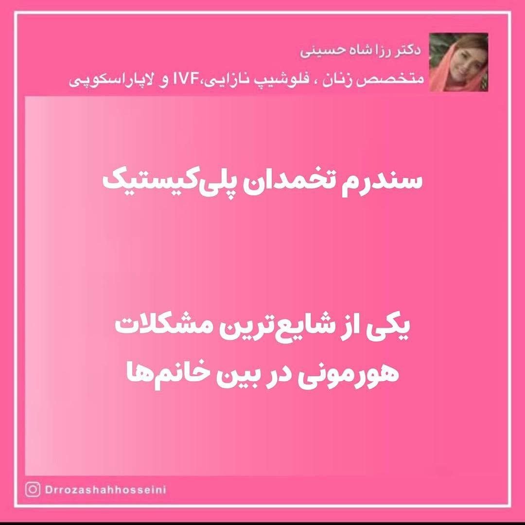 سندرم تخمدان پلی کیستیک