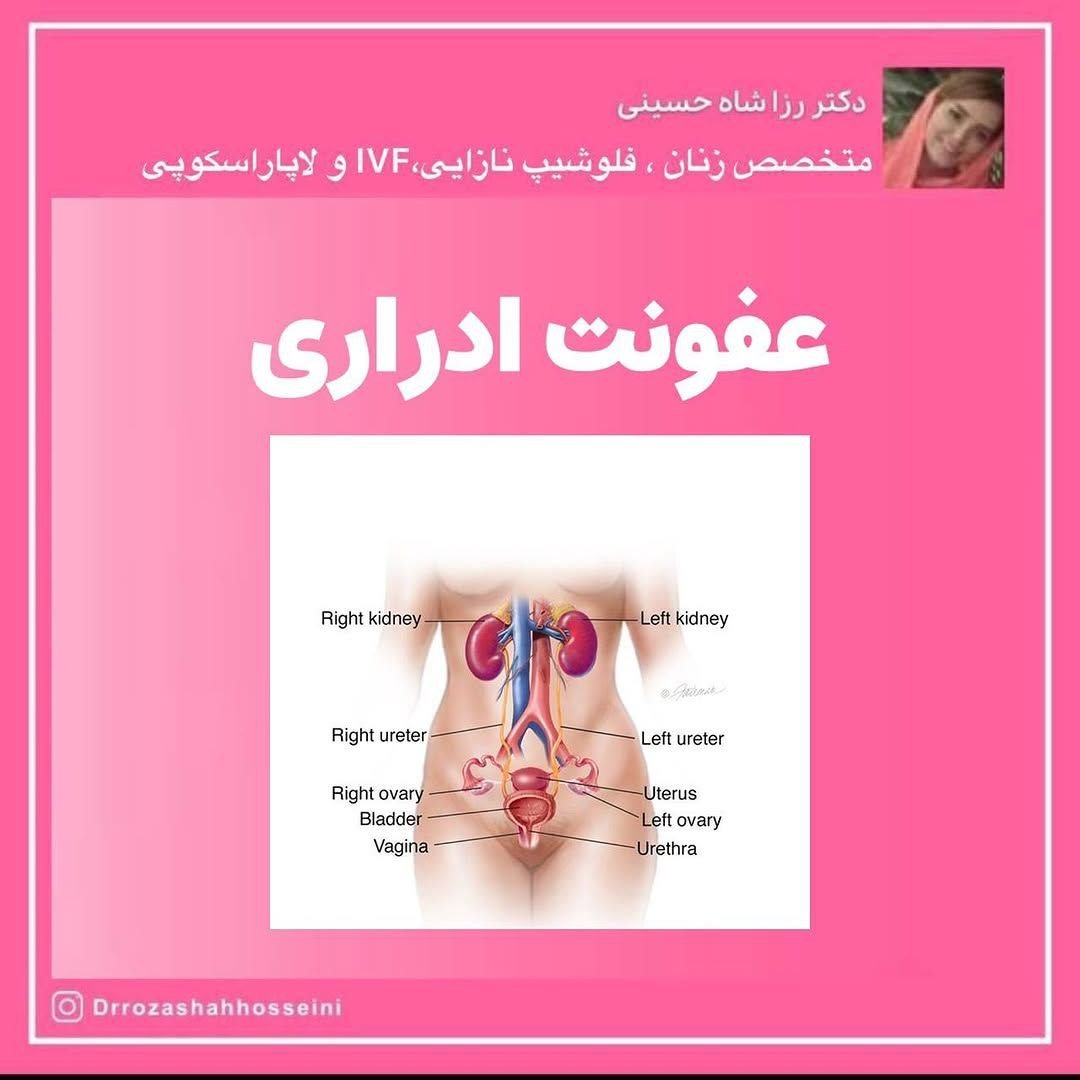 عفونت ادراری